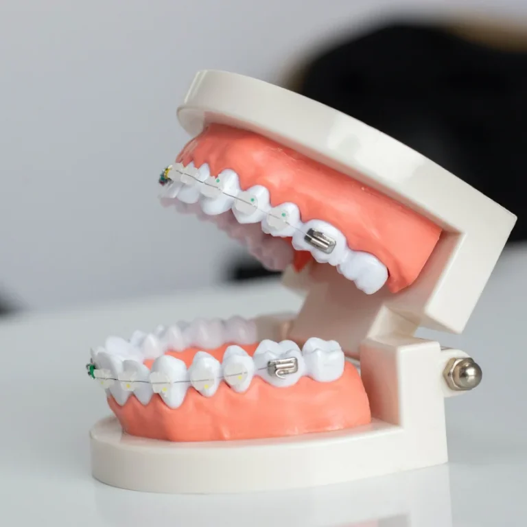 Kozmetik Diş Hekimliği